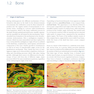 Principles of Internal Fixation of the Craniomaxillofacial Skeleton : Trauma and Orthognathic Surgery 2012