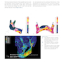 Principles of Internal Fixation of the Craniomaxillofacial Skeleton : Trauma and Orthognathic Surgery 2012