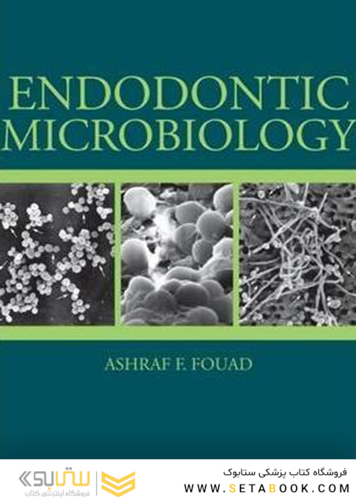 Endodontic Microbiology
