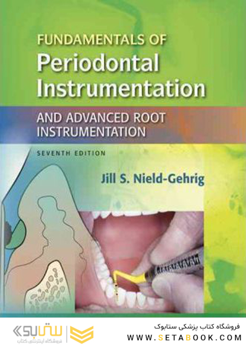 Fundamentals of Periodontal Instrumentation and Advanced Root Instrumentation
