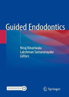عکس Guided Endodontics 2021