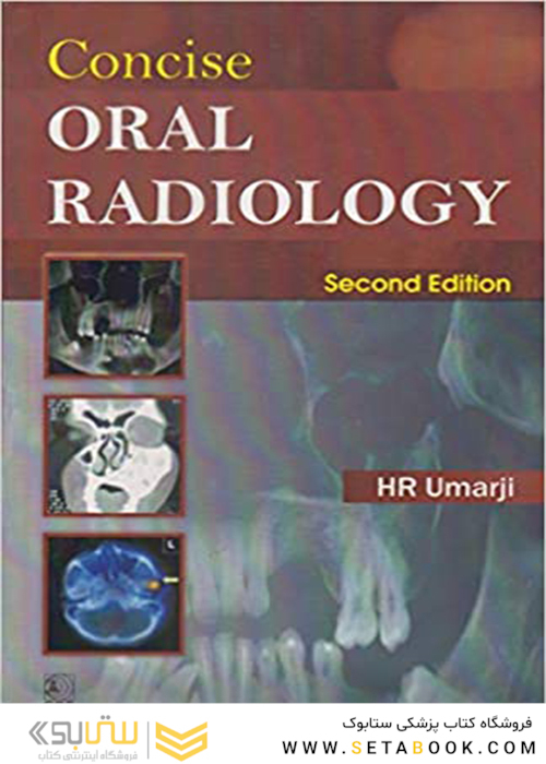 Concise Oral Radiology