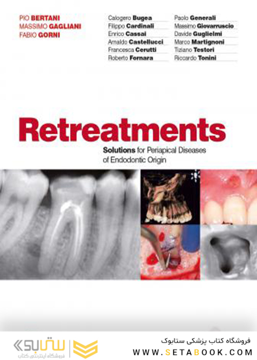 Retreatment. Solutions for apical diseases of endodontic origin