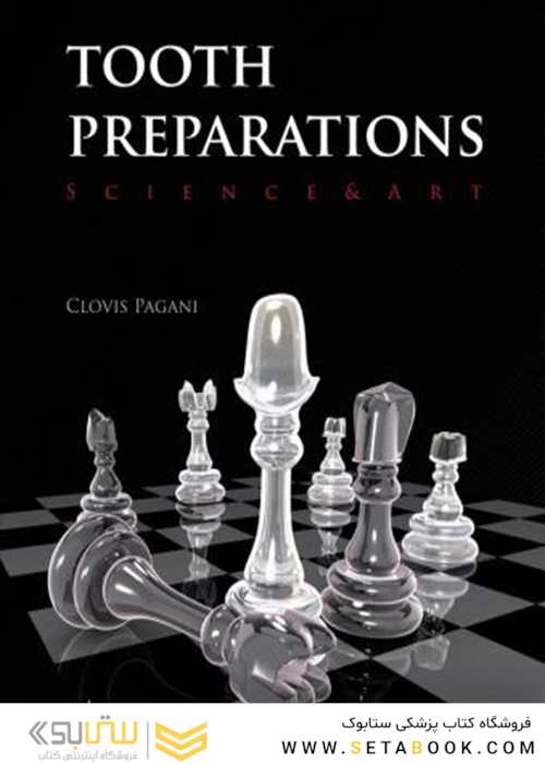 Tooth Preparations 1st Edicion 2017