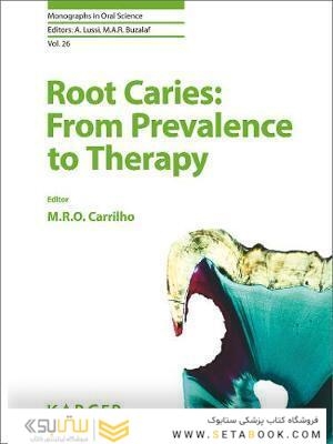 Root Caries: From Prevalence to Therapy