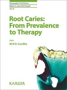 عکس Root Caries: From Prevalence to Therapy