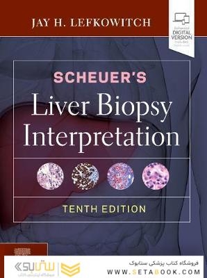 Scheuer