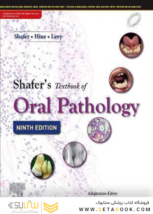 Shafer