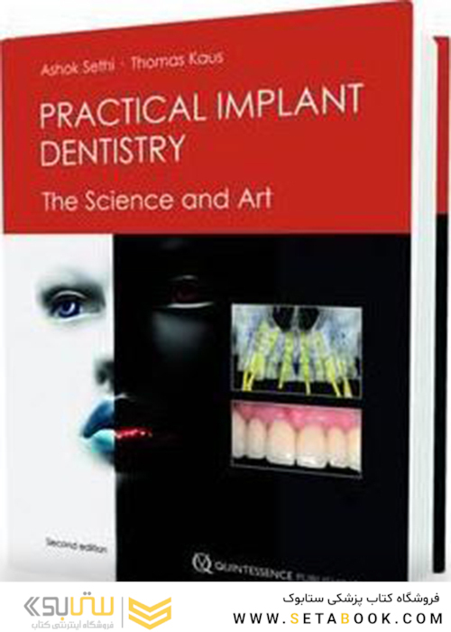 Practical Implant Dentistry 2012