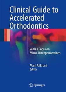 عکس Clinical Guide to Accelerated Orthodontics : With a Focus on Micro-Osteoperforations