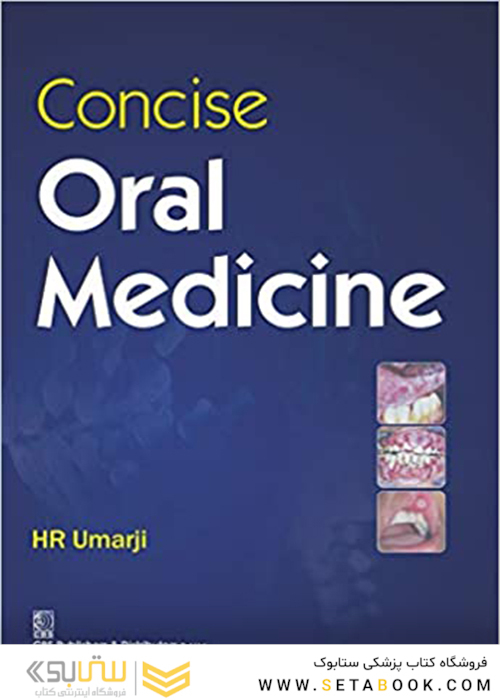 Concise Oral Medicine 2018