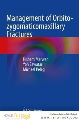Management of Orbito-zygomaticomaxillary Fractures 2021