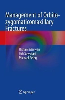عکس Management of Orbito-zygomaticomaxillary Fractures 2021