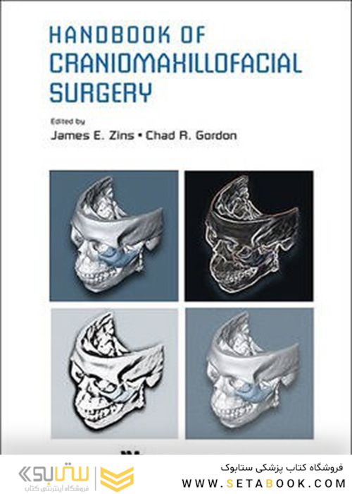 Handbook Of Craniomaxillofacial Surgery
