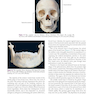 Atlas of Oral and Maxillofacial Surgery