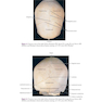 Atlas of Oral and Maxillofacial Surgery