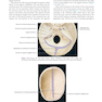 Atlas of Oral and Maxillofacial Surgery