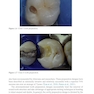 Material-Tissue Interfacial Phenomena : Contributions from Dental and Craniofacial Reconstructions 2017