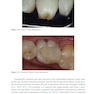 Material-Tissue Interfacial Phenomena : Contributions from Dental and Craniofacial Reconstructions 2017