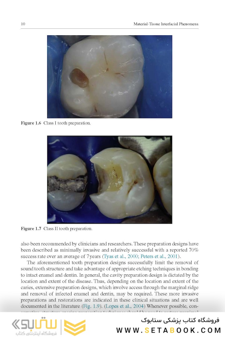 Material-Tissue Interfacial Phenomena : Contributions from Dental and Craniofacial Reconstructions 2017