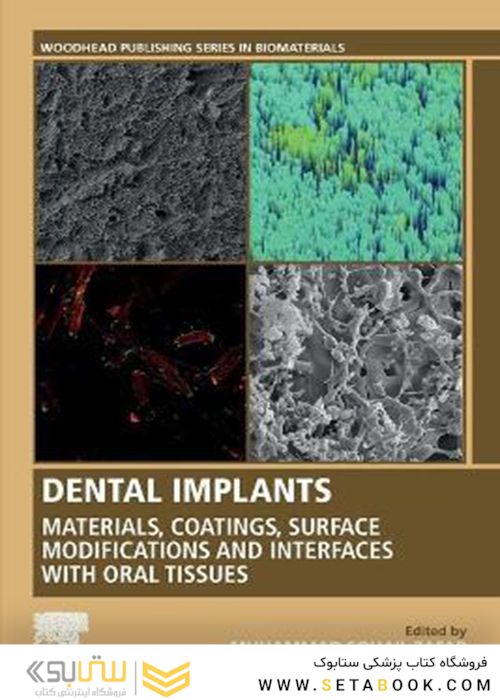Dental Implants : Materials, Coatings, Surface Modifications and Interfaces with Oral Tissues