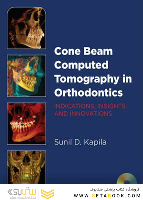 Cone Beam Computed Tomography in Orthodontics : Indications, Insights, and Innovations