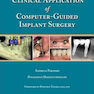 Clinical Application of Computer-Guided Implant Surgery