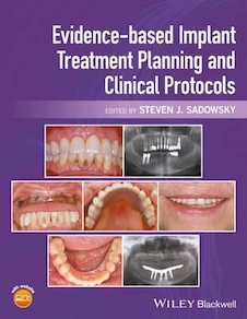 عکس Evidence-based Implant Treatment Planning and Clinical Protocols