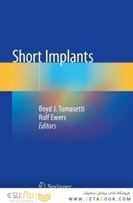 Short Implants