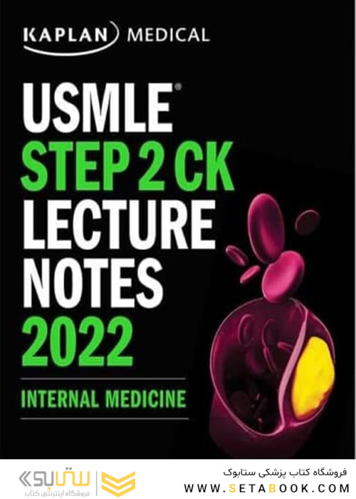 USMLE Step 2 CK Lecture Notes 2022: Internal Medicine