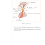 USMLE Step 2 CK Lecture Notes 2022: Internal Medicine