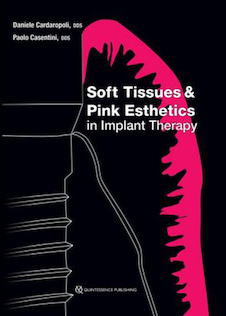 عکس Soft Tissues - Pink Esthetics in Implant Therapy