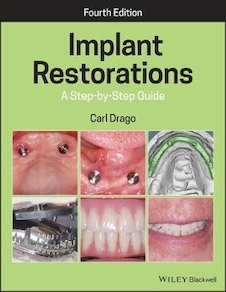 عکس Implant Restorations : A Step-by-Step Guide