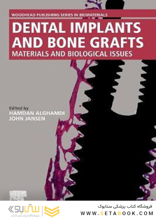Dental Implants and Bone Grafts : Materials and Biological Issues