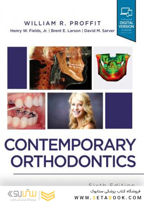 Contemporary Orthodontics