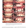 Contemporary Orthodontics
