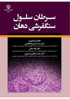 عکس سرطان سلول سنگفرشی دهان