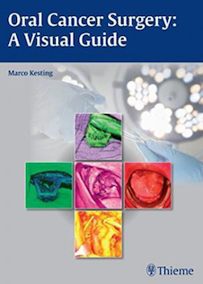 عکس Oral Cancer Surgery : A Visual Guide