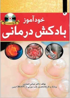 عکس خود آزموز بادکش درمانی