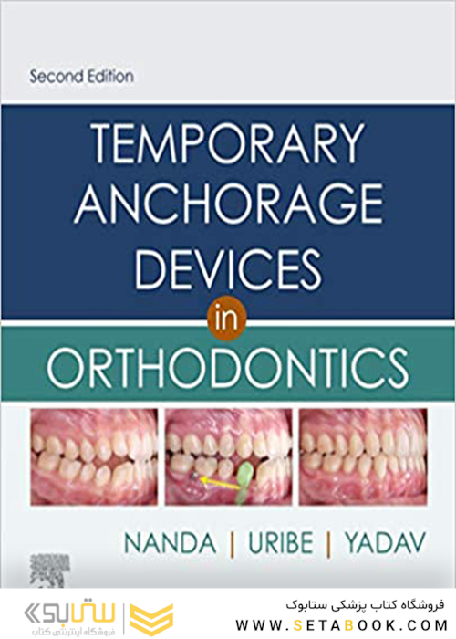 Temporary Anchorage Devices in Orthodontics 2nd Edition 2021