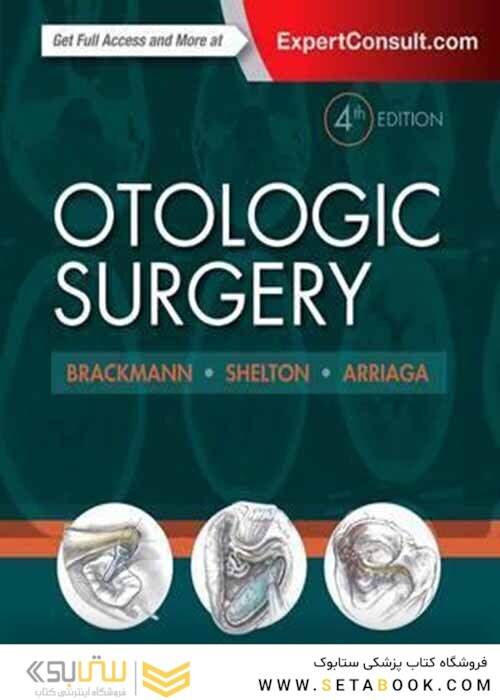 Otologic Surgery