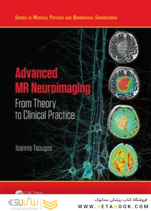 Advanced MR Neuroimaging : From Theory to Clinical Practice