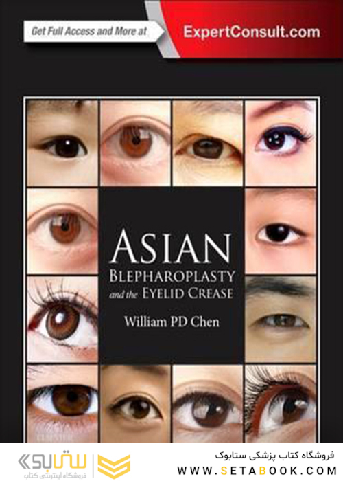 Asian Blepharoplasty and the Eyelid Crease 3rd Edition