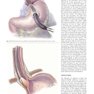 Mastery of Endoscopic and Laparoscopic Surgery Fourth Edition
