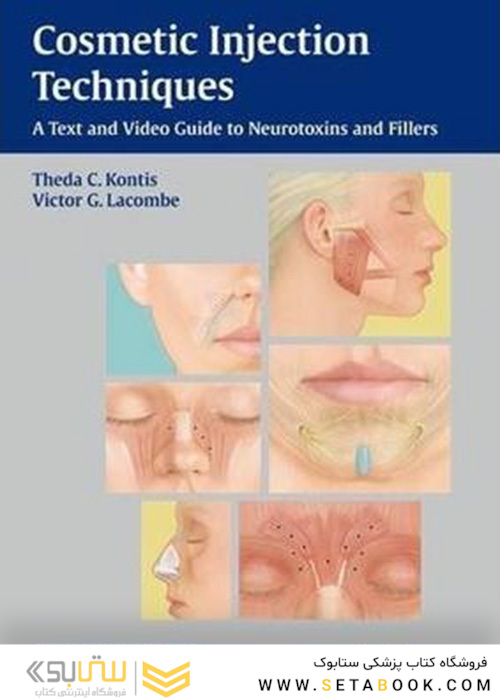 Cosmetic Injection Techniques