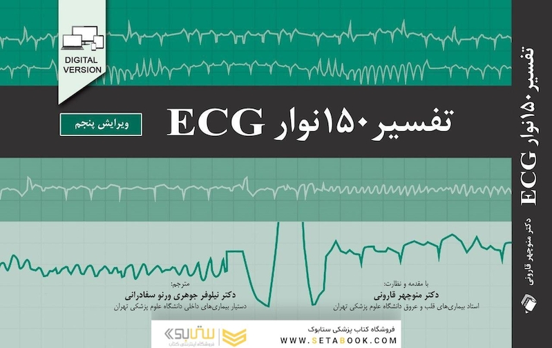 تفسیر 150 نوار ECG ویرایش پنجم