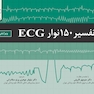 تفسیر 150 نوار ECG ویرایش پنجم