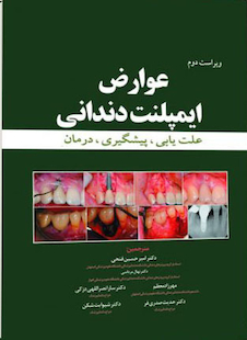 عکس عوارض ایمپلنت دندانی