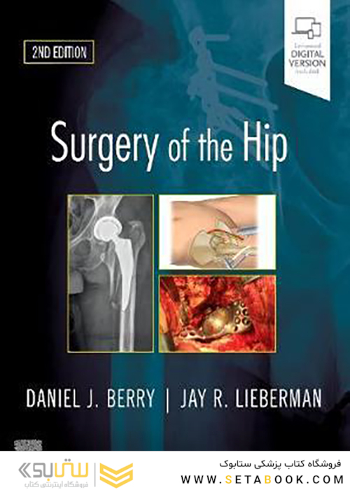 Surgery of the Hip: 2nd Edition2019 جراحی مفصل ران: مشاوره متخصص