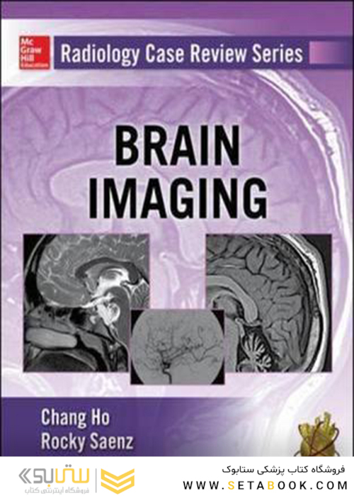 Radiology Case Review Series: Brain Imaging 1st Edition